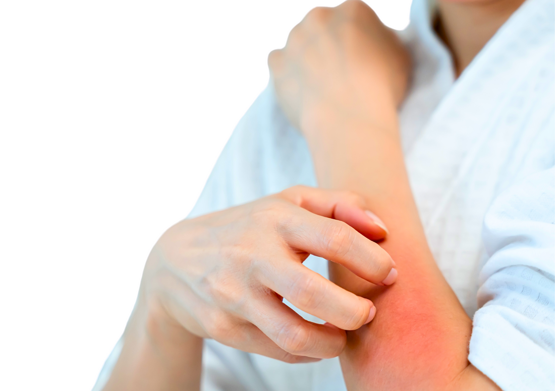 5 Signs Your Skin Barrier Is Asking for Help